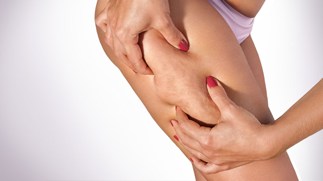 درمان سلولیت با دستگاه اندرمولب